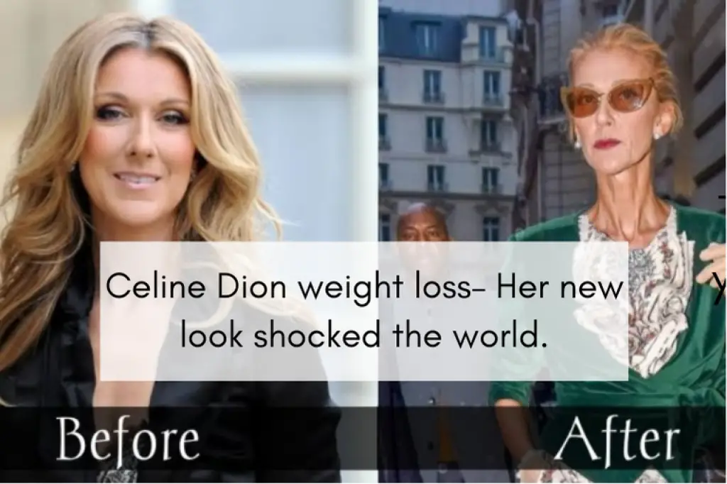 Celine Dion weight loss– Her new look shocked the world.
