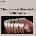 Foods to eat after wisdom teeth removal