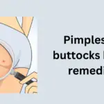 Pimples on buttocks home remedies