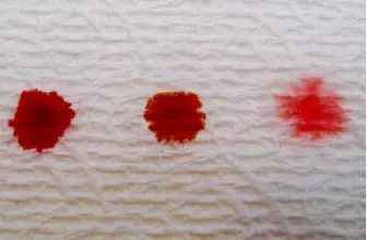 Spotting or bleeding in early pregnancy | should you be worried?
