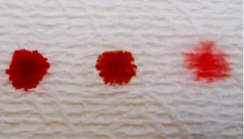 Spotting or bleeding in early pregnancy | should you be worried?