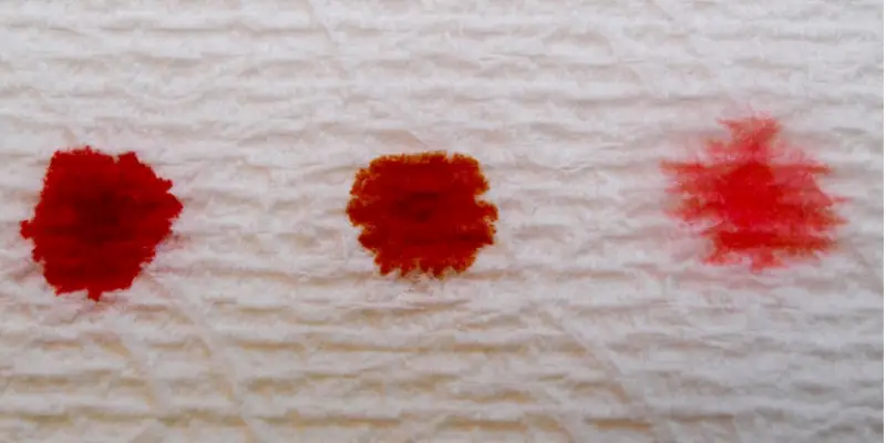 Spotting or bleeding in early pregnancy | should you be worried?